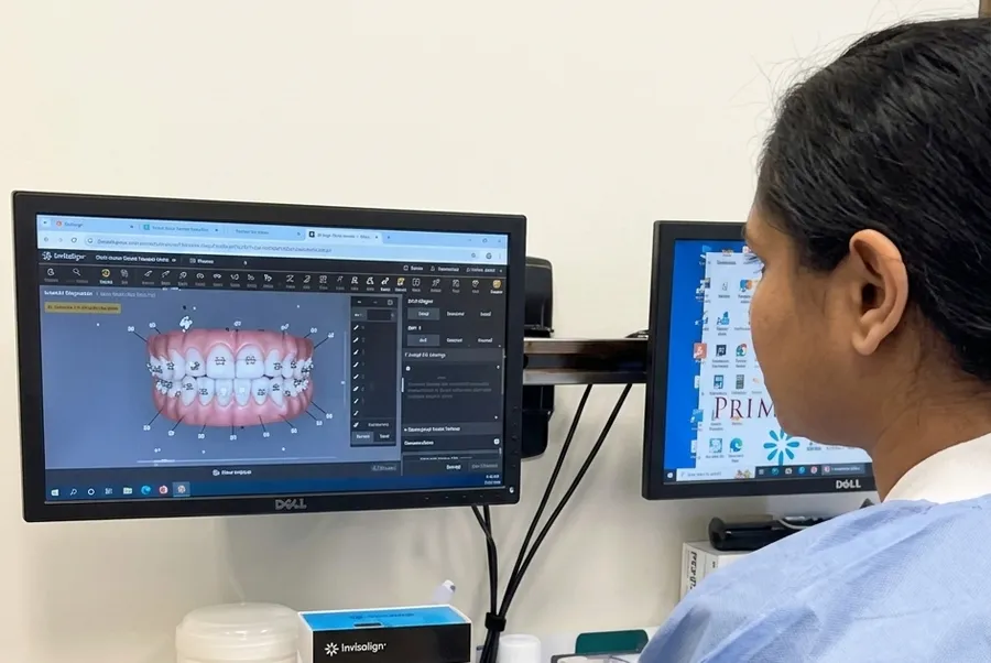 Digital smile design on screen at Premier Arts Dental